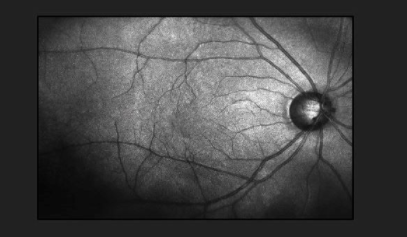 基因治疗项目临床开发转变后的 Adverum Down 中网时尚,stylechina.com