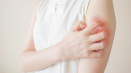 新药证明可以缓解慢性自发性荨麻疹的瘙痒 中网时尚,stylechina.com