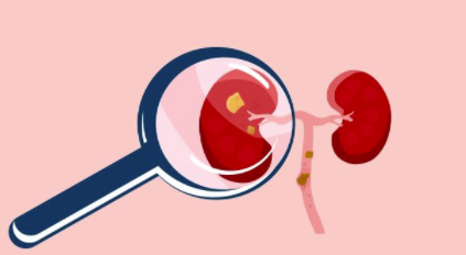 罕见病药物亚型绊倒 Dicerna 的结果不一致 中网时尚,stylechina.com