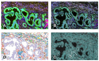 NanoString 发布使用新型 CosMx 空间分子成像仪生成的高分辨率 FFPE 组织数据集 中网时尚,stylechina.com
