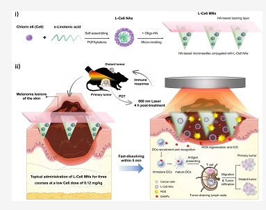 浙江大学高建青教授《ACS Nano》:微量光敏剂联合小小微针贴，发挥原位及远端黑色素瘤抗肿瘤效应 中网时尚,stylechina.com