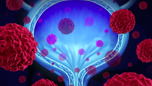 CG 肿瘤学团队与默克、BMS 合作获得膀胱癌阳性结果 中网时尚,stylechina.com